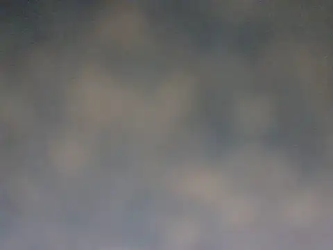 Chat ao vivo de Petebulimia