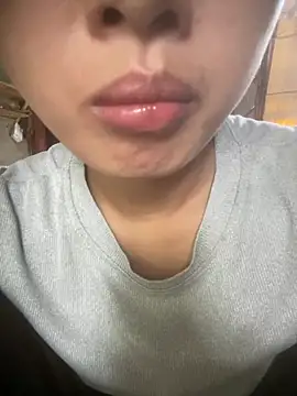 Živá chatovací místnost LINSA-0269